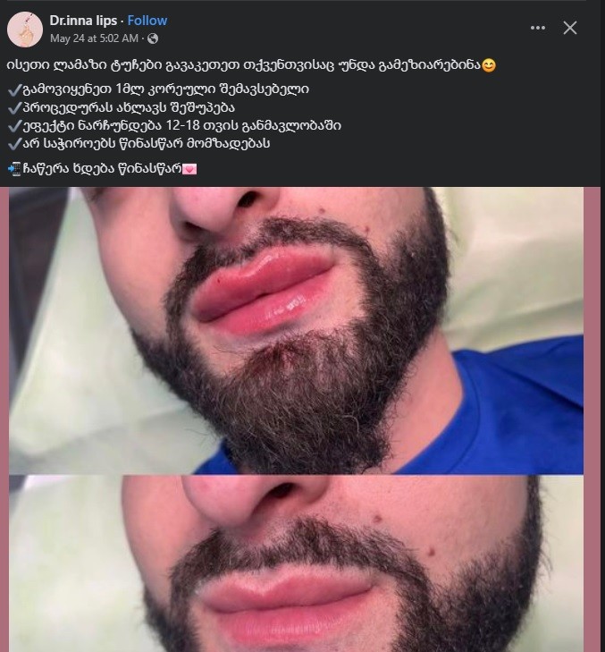 user posted image