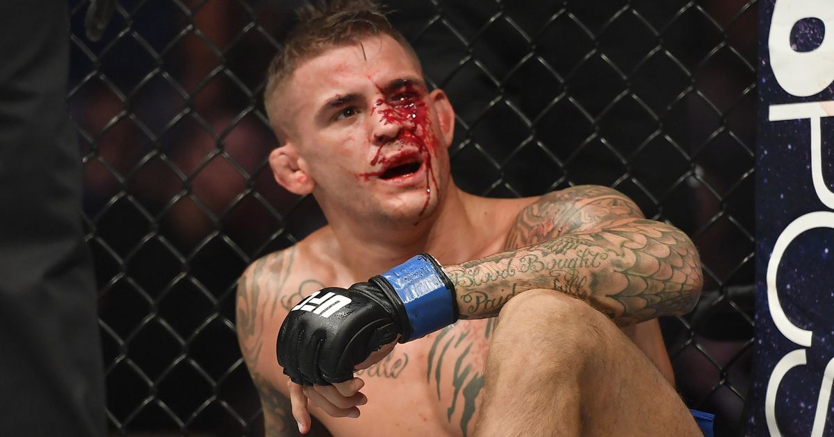 051517_ufc_dustin_poirier.vresize.1200.630.high.90.jpg