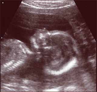 my_baby.jpg