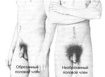 obreza.JPG