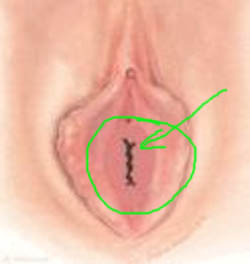 hymen_2_copy.jpg