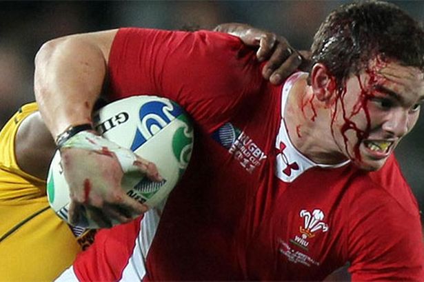a_bloodied_george_north_battles_on_717275187.jpg