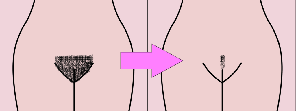 pubic_hair_transition_1_1024x384.png