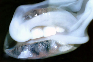 lips1_1_.jpg