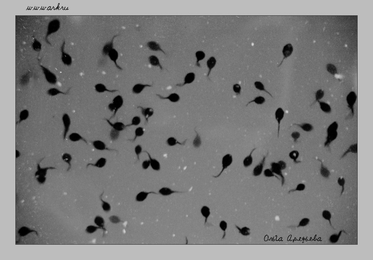 09_spermatozoidy.jpg