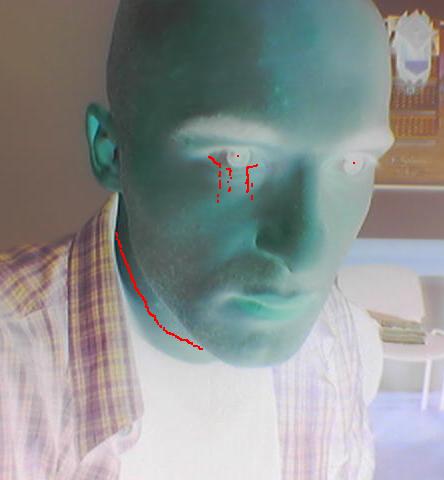blood.JPG