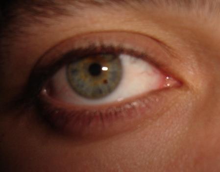 eye.JPG