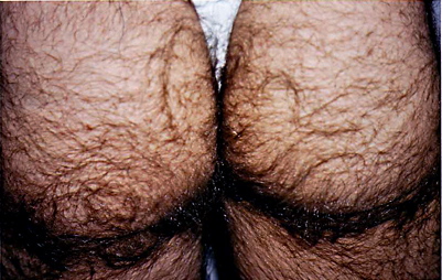 hairy_butt.jpeg