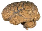 150px_Human_brain_NIH.jpg