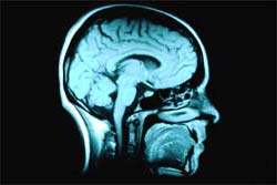 brain_scan.jpg
