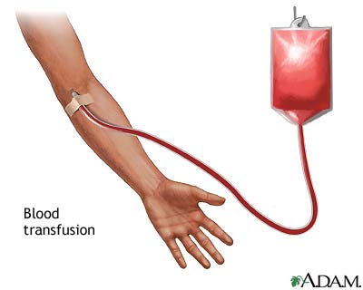 blood_transfusion.jpg