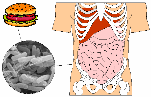 859foodpoisoning_E._coli_.gif