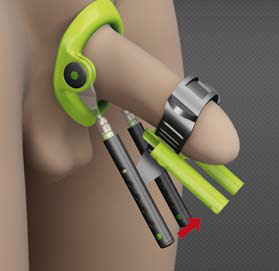 penis_enlargement_08.jpg