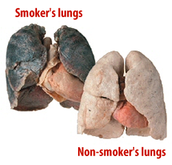 smokers_lungs_comparison1.png