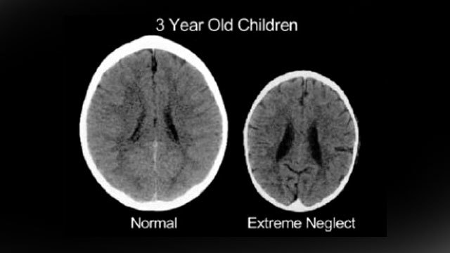 is_this_the_most_misleading_image_in_neuroscience.jpg