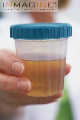 urine20cup.jpg