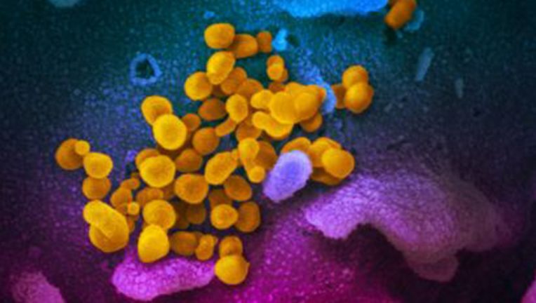 Coronavirus_SARS_CoV_2_NIAID_2.jpg