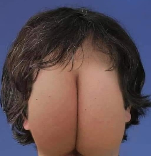 ___.png