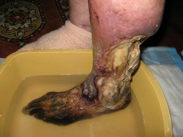krokodil.jpg