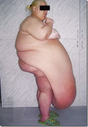russian_woman_natalya_m_belly_fat_picture33.jpg