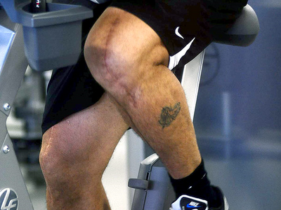 Ronaldo_Knee.png