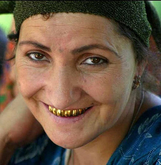 gold_teeth_lady.jpg