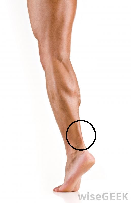 strained_muscle.jpg