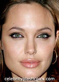 angelina_jolie_after1.jpg