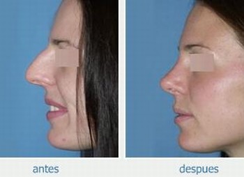 017820_119659_ZOOM_PRODUCTO.jpg