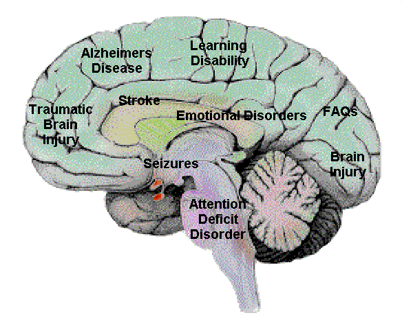 brain_injury.gif