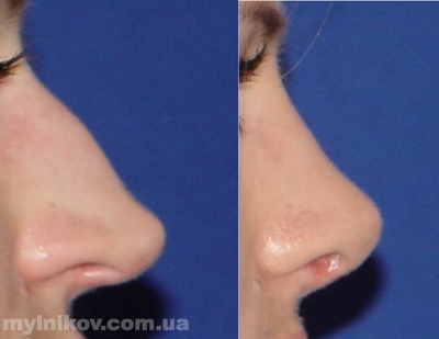 nose2.jpg