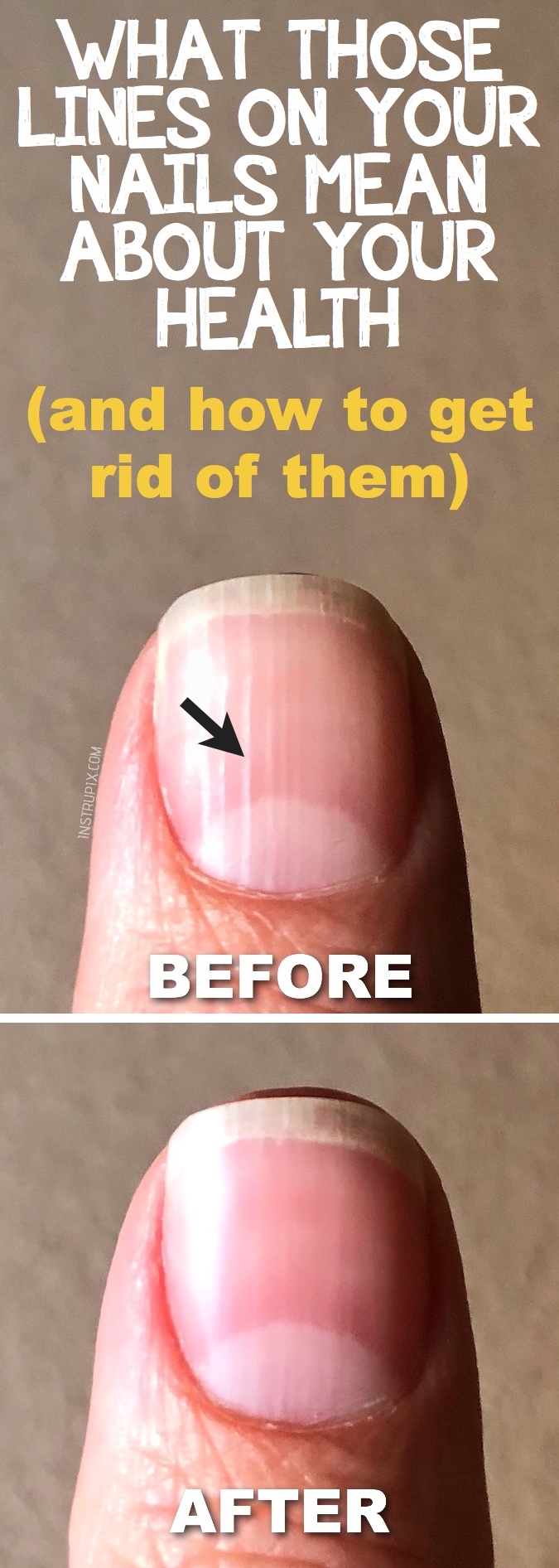 before.jpg