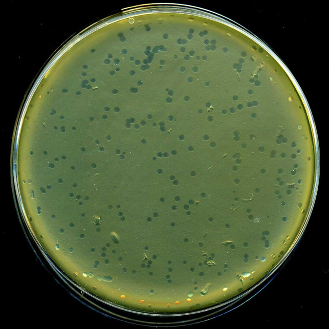 A_10_cm_diameter_lawn_culture_of_bacteria_infected_by_bacteriophages.png