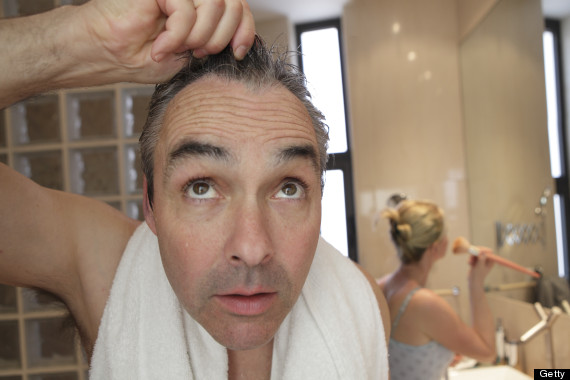 o_BALDNESS_570.jpg
