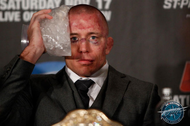 george_st_pierre_bruised_face.jpg