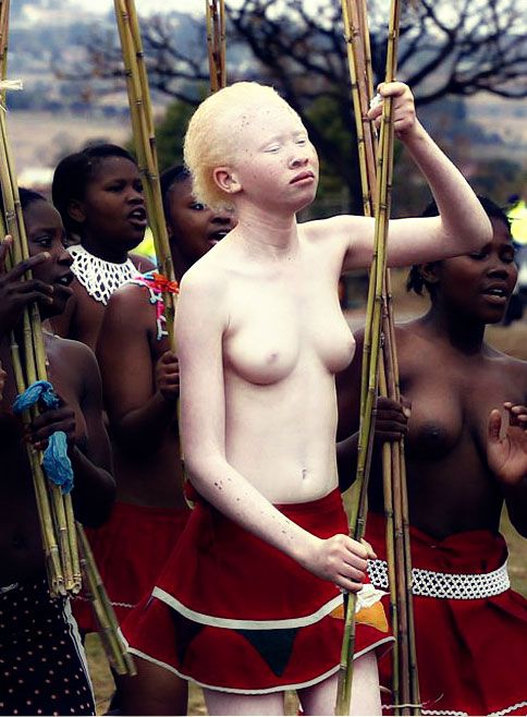 Albino_dancer__South_Africa.jpg