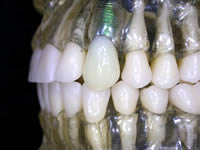 implant_7_2_.jpg