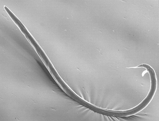 Panagrellus_redivivus.jpg