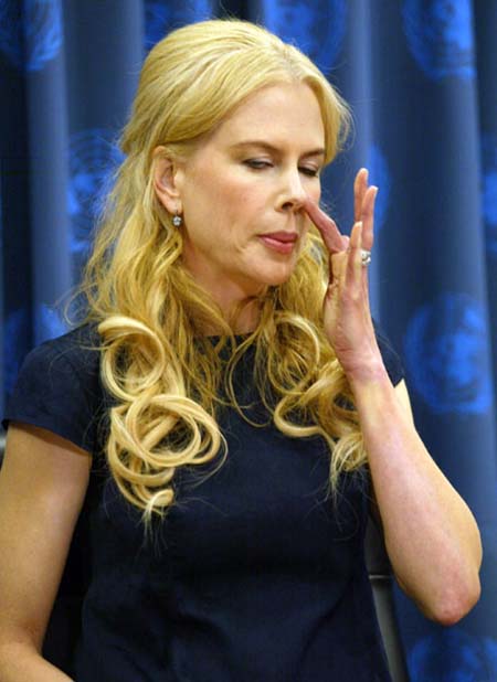 nicole_kidman_no_botox_1.jpg