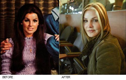 priscilla_presley_surgery1.JPG