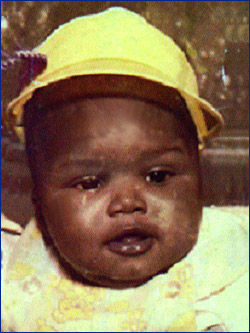j_oneal_child_250.jpg