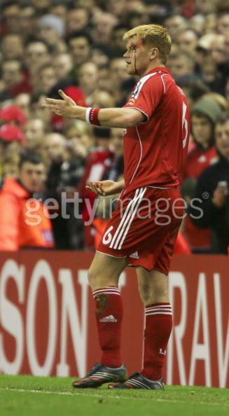 Bloody_Riise.jpg