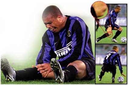 ronaldoinfortunio.jpg