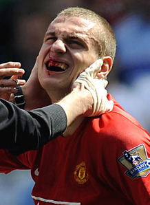 Nemanja_Vidic_Manchester_United_Premier_Leagu_821021.jpg