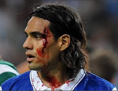 Radamel_Falcao_corte_en_la_cara_Portugal.jpg