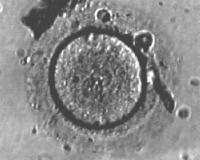 human_reproduction_egg1.jpg