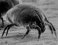 250px_House_Dust_Mite.jpg