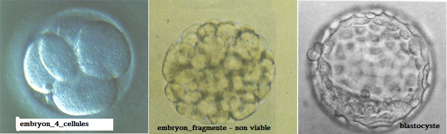 embryon.jpg
