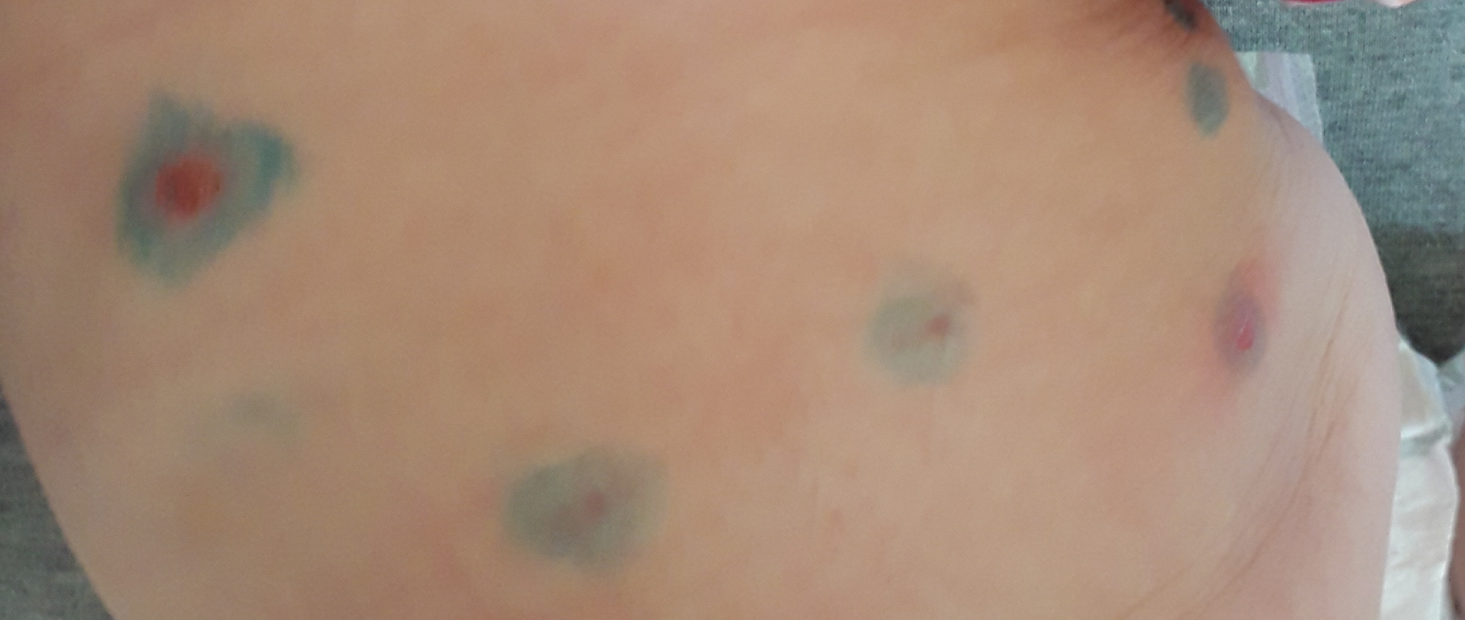 20170817_173150.jpg