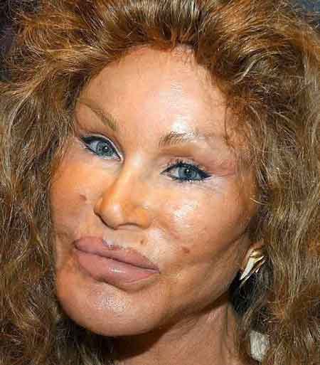 jocelyn_wildenstein_horror.jpg